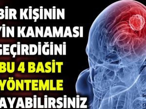 BİR KİŞİNİN BEYİN KANAMASI GEÇİRDİĞİNİ BU DÖRT BASİT YÖNTEMLE ANLAYABİLİ