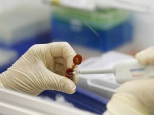 HEMEN BİR HASTANEYE KOŞUN! BU BELİRTİLER SİZDE DE VAR MI? EĞER VARSA YAN