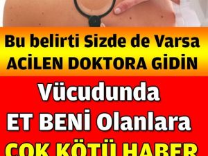 Vücudunda ET BENİ olanlara Çok K-ötü Haber