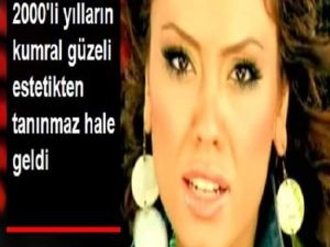 2000'li yılların güzel şarkıcısı estetikten tanınmaz hale geldi!