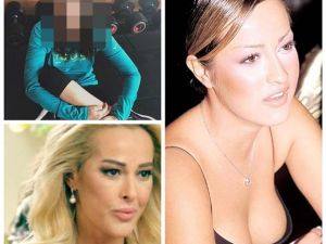 Helin Avşar'ın son halini gören tanıyamıyor 4 estetik operasyon geç