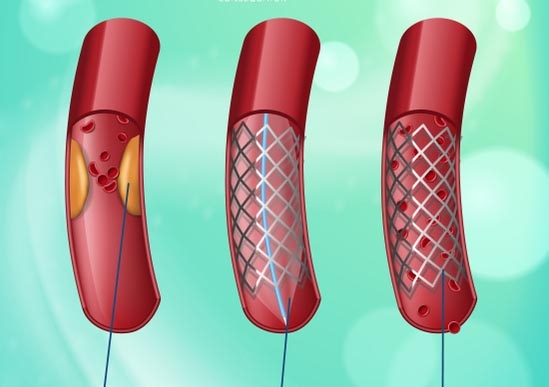 Damarlarınızı Tertemiz Yapacak Sır Tarif galerisi resim 4