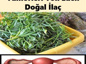 Kadınlarda Kist ve T-ümörlere Karşı Doğal Reçete