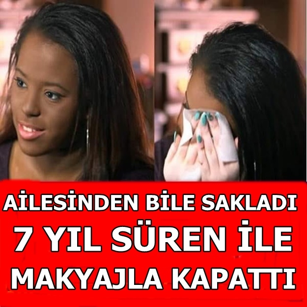 7 YIL BOYUNCA YAPTIĞI MAKYAJLA AİLESİNDEN BİLE SAKLADI galerisi resim 1