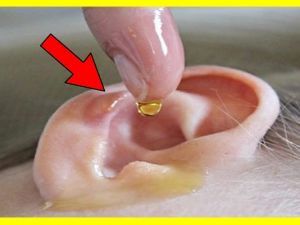 Kulağınıza 2 Damla Dökün İşitme Kaybına Elveda Deyin