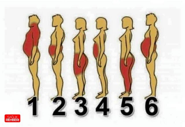 ŞİŞMANLAMA NEDENİNİZİ BİLİYOR MUSUNUZ? galerisi resim 6