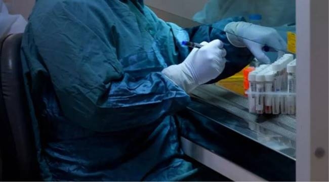 Sağlık Bakanı Koca’dan Türkiye’ye Çok Güzel Haberi Şimdi Duyurdu galerisi resim 1