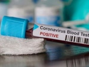 Koronvirüsün En Sevdiği Kan Grubu