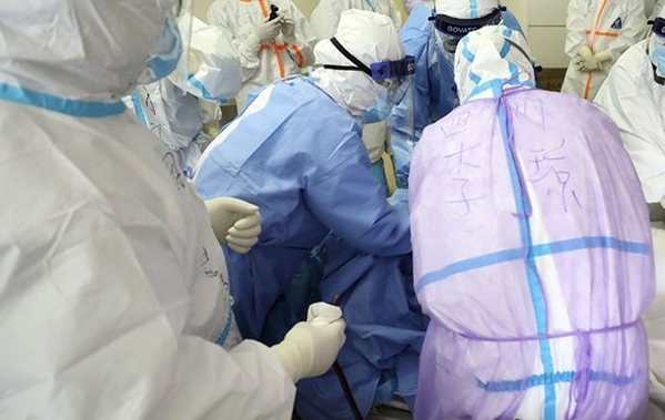 Dünya sağlık açıkladı galerisi resim 1