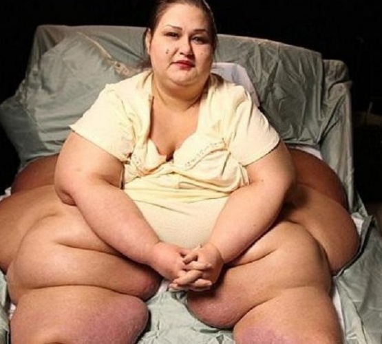 Son Halini Görün Şaştı Kaldı galerisi resim 1