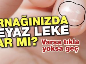 TIRNAKTA O BEYAZ LEKELER HASTALIK HABERCİSİ