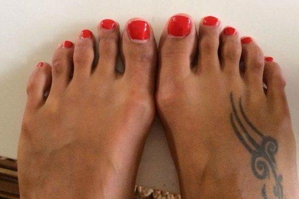 YOK ARTIK...! TOPUKLU AYAKKABI GİYEBİLMEK İÇİN... galerisi resim 2