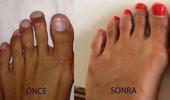 YOK ARTIK...! TOPUKLU AYAKKABI GİYEBİLMEK İÇİN... galerisi resim 3