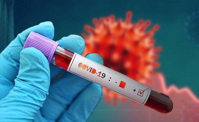 O İsim Koronadan Öldü galerisi resim 2