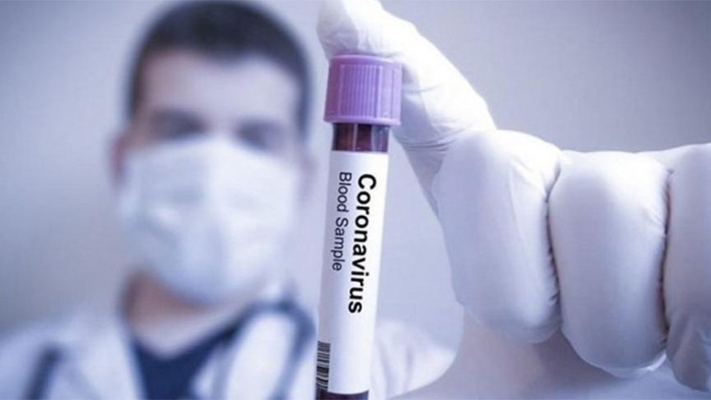 Koronavirüs'ün En Sevdiği Kan Grubu Belli Oldu galerisi resim 6