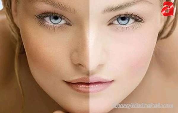 Cilt Lekelerine Son...! 20 DAKİKADA LEKE TEDAVİSİ...! galerisi resim 3