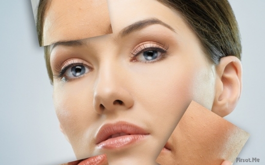 Cilt Lekelerine Son...! 20 DAKİKADA LEKE TEDAVİSİ...! galerisi resim 5