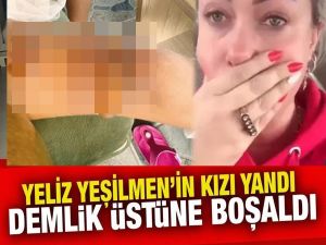 Demlik Üstüne Boşaldı;