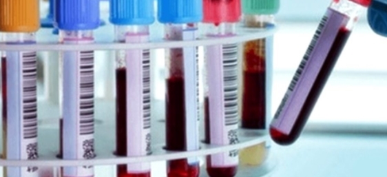 En Ağır ve En Hafif Geçiren Kan Grupları Belli Oldu galerisi resim 2