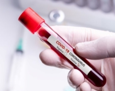 En Ağır ve En Hafif Geçiren Kan Grupları Belli Oldu galerisi resim 4