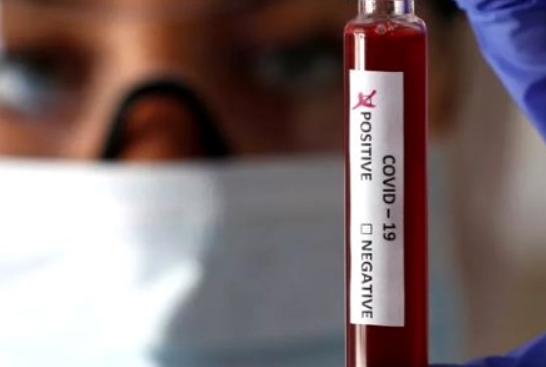 En Ağır ve En Hafif Geçiren Kan Grupları Belli Oldu galerisi resim 7