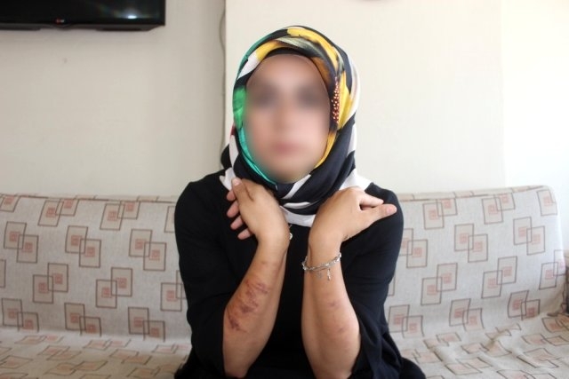 Lazer yaptırmak isterken az kalsın hayatından oluyordu galerisi resim 5