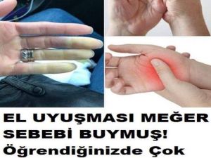 Eliniz Uyuşuyor İse Sebebi