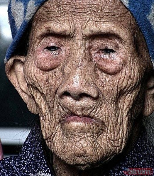 MUCİZESİNİ AÇIKLADI galerisi resim 3