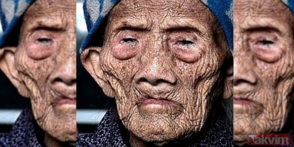 MUCİZESİNİ AÇIKLADI galerisi resim 5