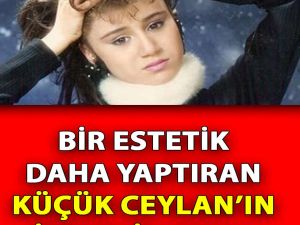 Bir Estetik Daha Yaptıran Ceylan'ın son hali