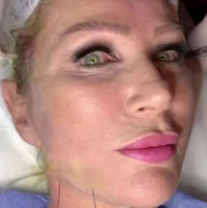 Estetik Yaptıran Seda Sayan'ın İbretlik Sonu galerisi resim 3