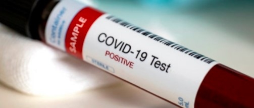 Artık Herkesten alınıyormuş galerisi resim 4