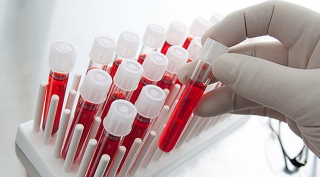 Koronavirüs Testi Pozitif Çıkana Para Verilecek galerisi resim 2