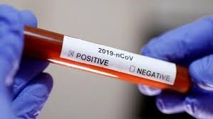 Koronavirüs Testi Pozitif Çıkana Para Verilecek galerisi resim 4