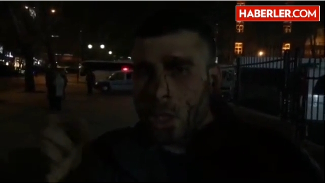 Ankara Saldırısının Görgü Tanığı Yaşadıklarını Anlattı galerisi resim 1