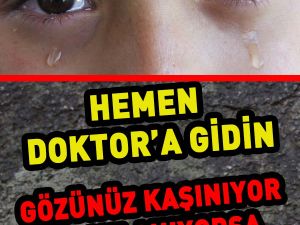 Gözünüz kaşınıyor ve sulanıyorsa dikkat! Mutlaka doktora gidin