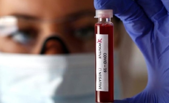 Canan Karatay Haklı Çıktı galerisi resim 2