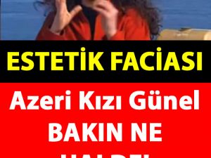 Estetik Yaptırayım Derken Bakın Ne Hale Geldi!