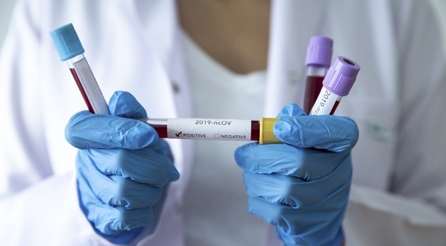 Koronada yeni gelişme Bu şehirlerde olanlar dikkat galerisi resim 7