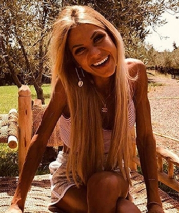 Zayıflama Hastalığı Yüzünden Canından Oldu galerisi resim 6