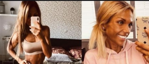 Zayıflama Hastalığı Yüzünden Canından Oldu galerisi resim 7