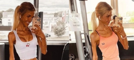 Zayıflama Hastalığı Yüzünden Canından Oldu galerisi resim 8