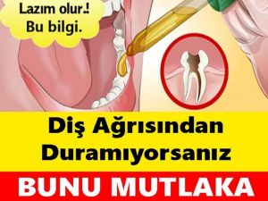 Diş Ağrısından Duramıyorsanız.....