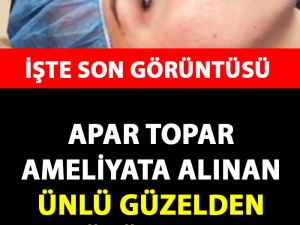 Burun Estetiği Yaptıran Ünlü İsimden Kötü Haber