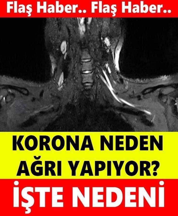 KORONA NEDEN AĞRI YAPIYOR? İŞTE NEDENİ galerisi resim 1