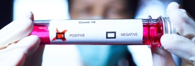 İlk Belirtisi Değişti Sizde de Varsa Doktora Gidin galerisi resim 6