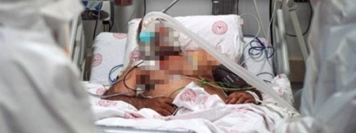 İlk Belirtisi Değişti Sizde de Varsa Doktora Gidin galerisi resim 7