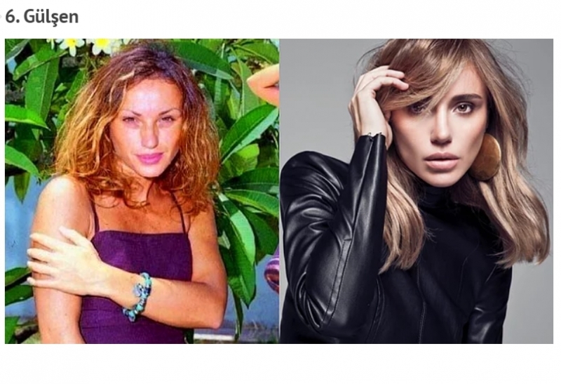 Estetik Yaptıran Ünlü İsmin İbretlik Sonu galerisi resim 9