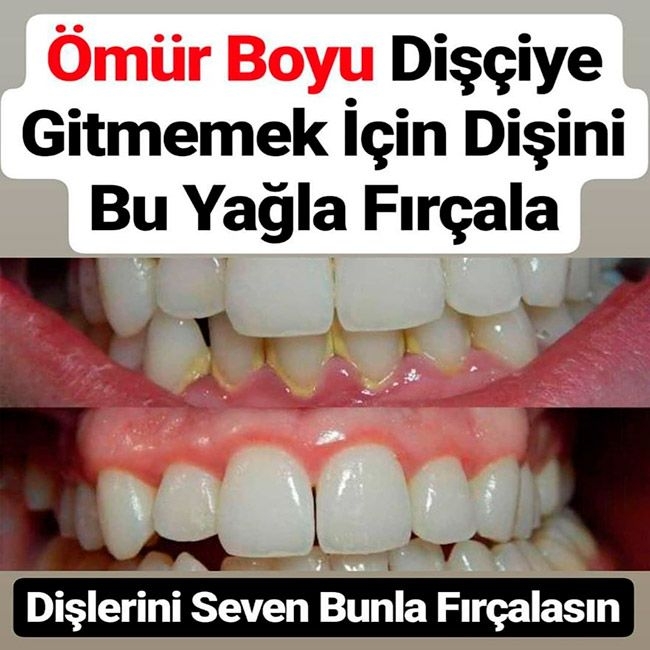 Ömür Boyu Dişçiye Gitmemek İçin Dişini Bu Yağla Fırçala galerisi resim 1