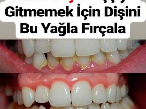 Ömür Boyu Dişçiye Gitmemek İçin Dişini Bu Yağla Fırçala